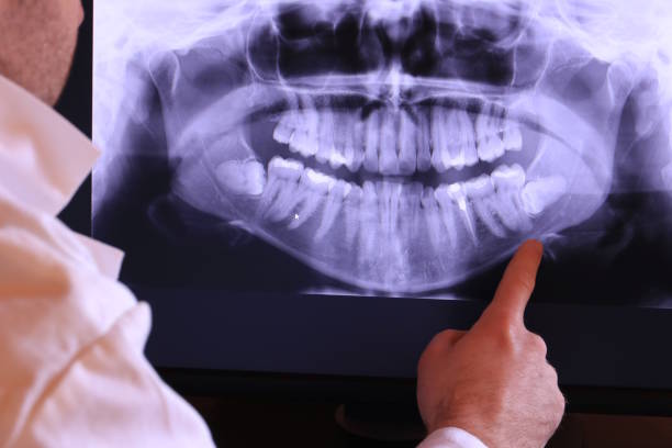 Best Emergency Dentist for Knocked-Out Tooth in Titusville, PA